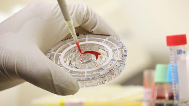 blood-test-ebola.jpg 