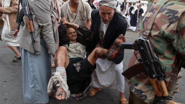 Bystanders try to save wounded man after suicide bombing in Sanaa 