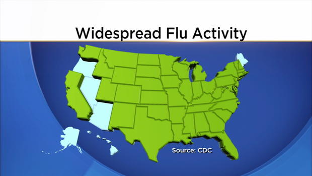 Flu Map 