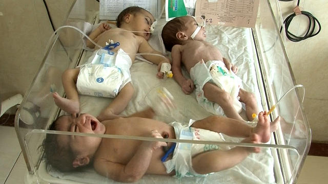 ​Three babies crowd a single bed in the overcrowded Indira Gandhi children's hospital in Kabul, Afghanistan 