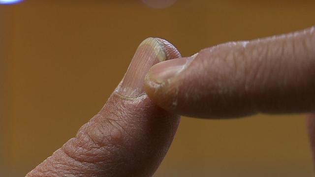 gross-picture-of-fingernails.jpg 