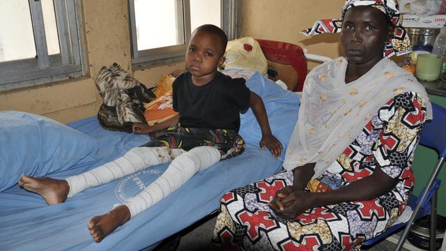 A mother sits with her child at state hospital as he receives treatment for injuries sustained following a Boko Haram bomb blast that left dozens dead and many injured in Maiduguri 