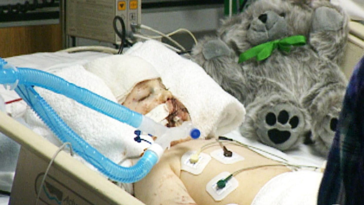 20 years later, wounds remain from Oklahoma City bombing CBS News