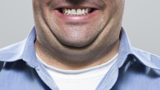 istock000016618912large-double-chin.jpg 