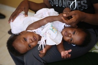 haiti-conjoined-twins.jpg
