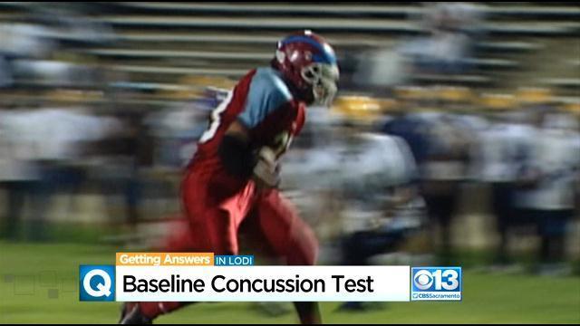 concussion-test.jpg 