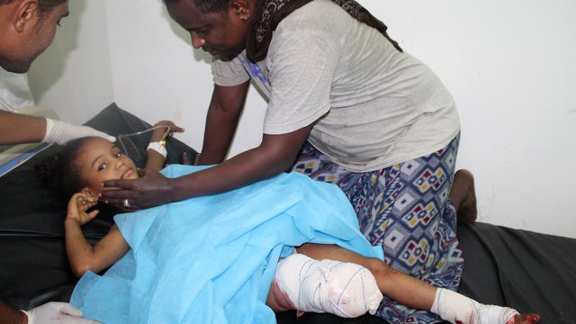 A badly wounded Yemeni girl lies on a hospital bed following a rocket attack by Huthi Shiite rebels and their allies in Aden's loyalist-held al-Mansura district Aden 