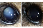 cataracts 