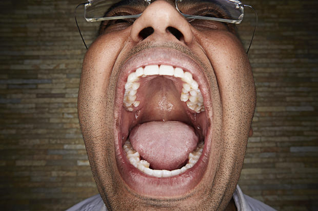 vijay-kumar-most-teeth-in-a-mouth0398.jpg 
