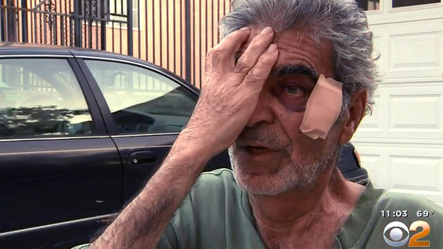 ​Sahak Sahakian, an elderly man injured in an attack over free samples of Nutella at a Burbank, California Costco store 