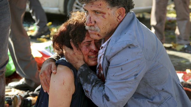 An injured man hugs an injured woman after an explosion during a peace march in Ankara, Turkey, Oct. 10, 2015. 