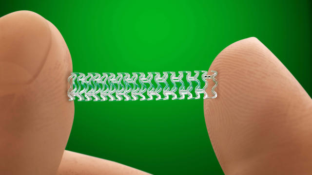 Abbott heart stent.jpg 