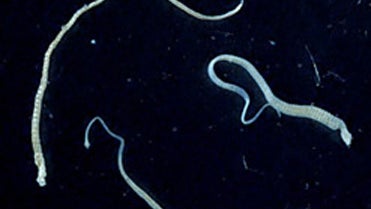 tapeworm.jpg 