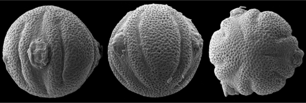 odontonema-aliciaemicroscopic-image-of-pollen-from-new-flowering-plantc-alicia-ibanez.png 