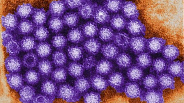 norovirus.jpg 