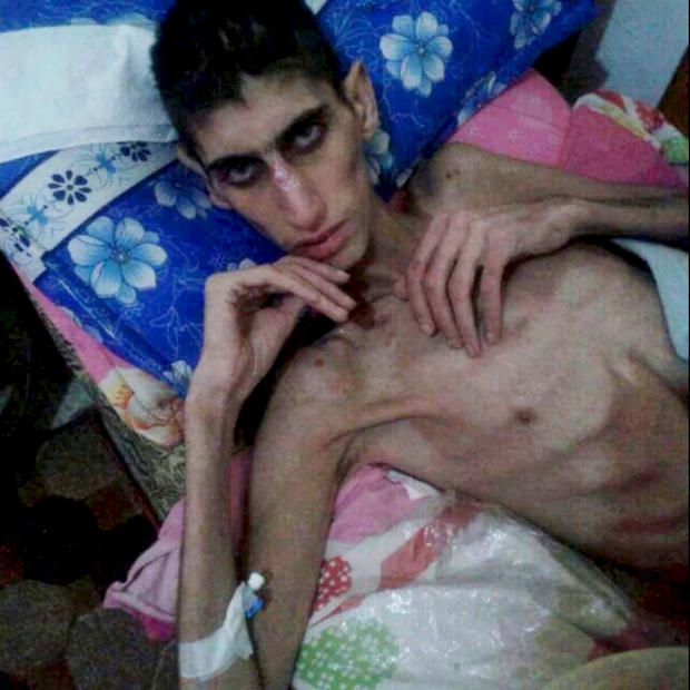 syria-starvation.jpg 
