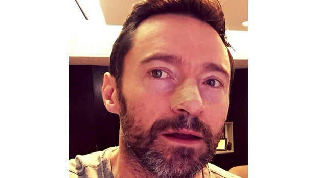 hugh-jackman-skin-cancer-selfie-copy.jpg 