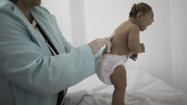 20 alarming facts about the Zika virus 