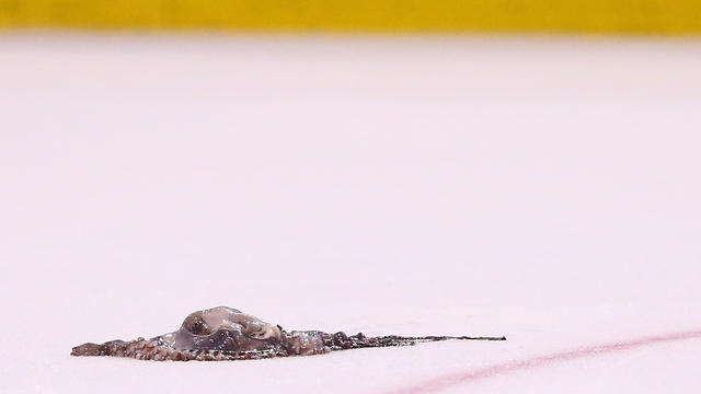 Man Says He Was Banned From LCA For Tossing Octopus On Ice