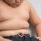 Use drugs, surgery early for obesity in kids, new guidelines say