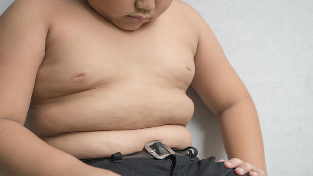 overweight-child.jpg 