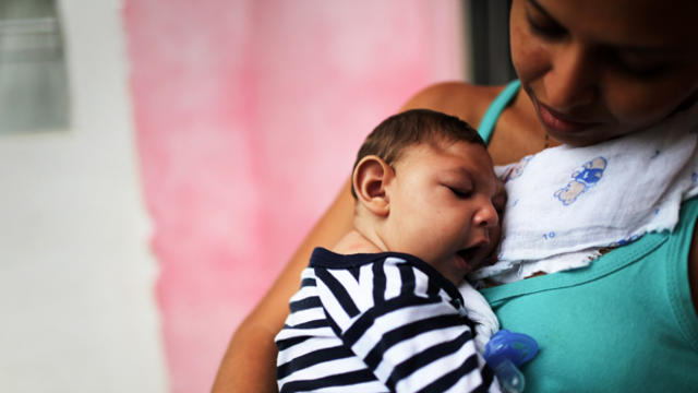 Mother Daniele Santos holds her baby Juan Pedro, who has microcephaly, on May 30, 2016, in Recife, Brazil. Microcephaly is a birth defect linked to the Zika virus where infants are born with abnormally small heads. 