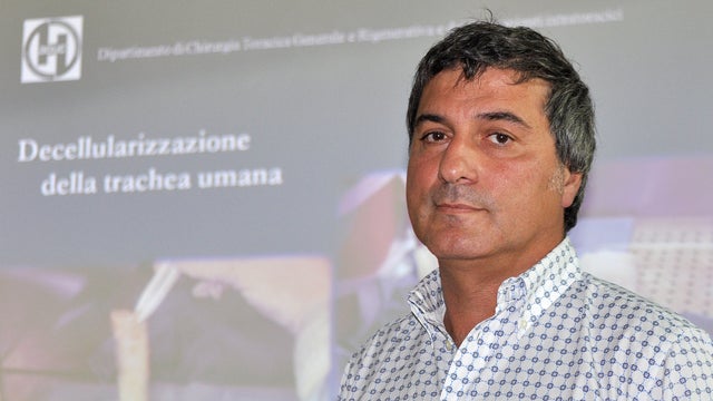 Dr. Paolo Macchiarini appears at a news conference announcing what he called the successful transplant of windpipes using innovative stem cell tissue regeneration, in Florence, Italy 