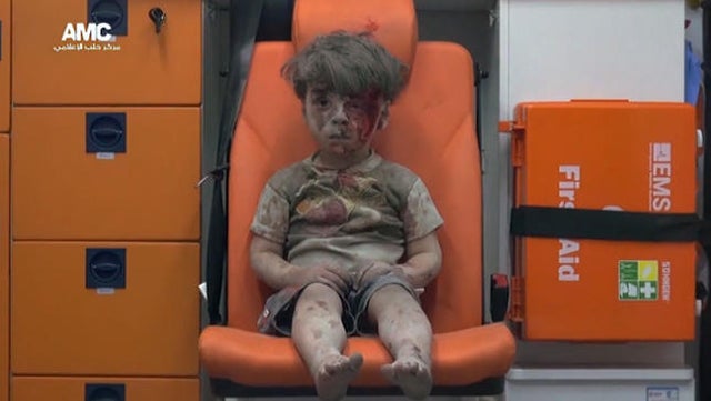 aleppo-injured-boy.jpg 
