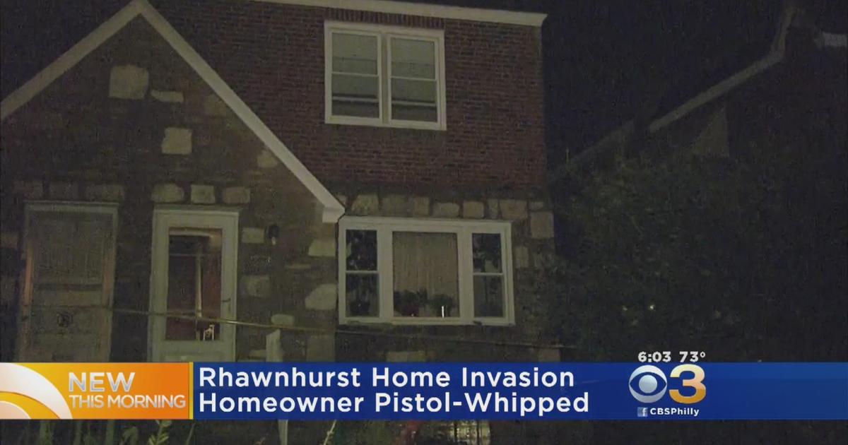 Homeowner Pistol Whipped In Rhawnhurst Robbery Cbs Philadelphia 3584