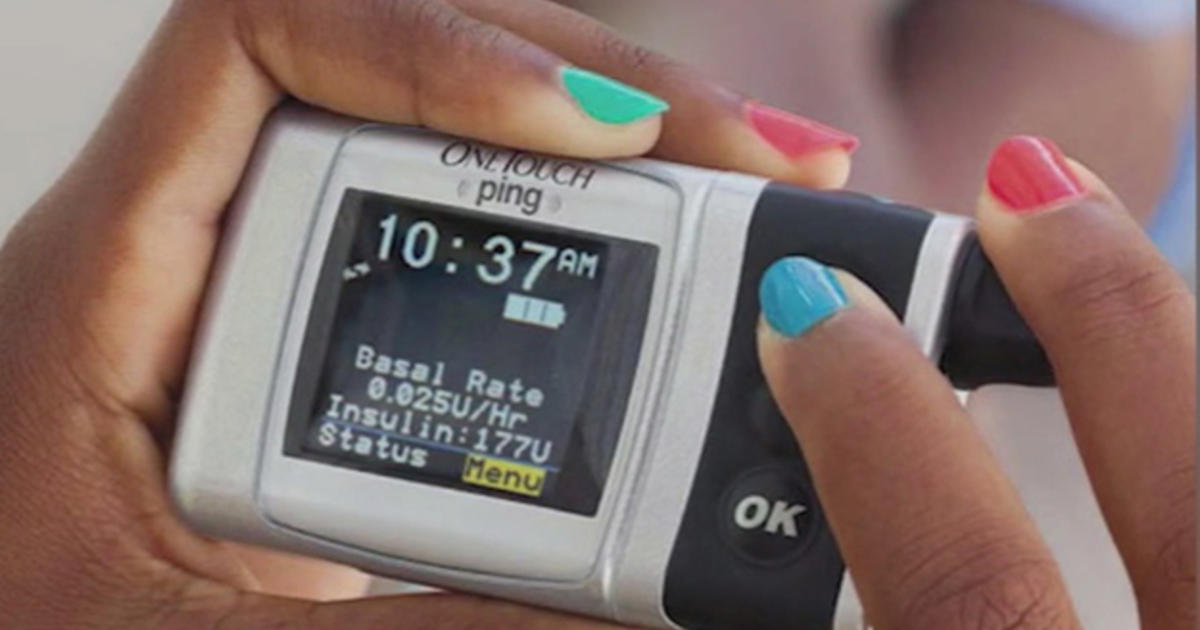 Johnson & Johnson recalls OneTouch VerioIQ blood glucose meters due to  malfunction - CBS News