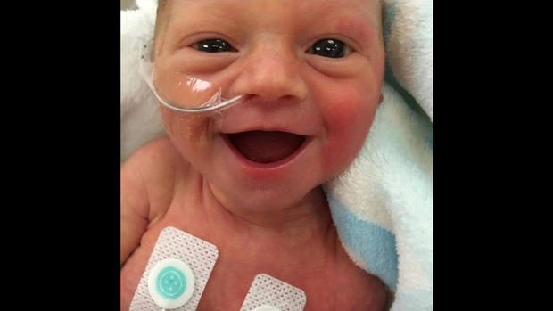 preemie-baby-with-smile 
