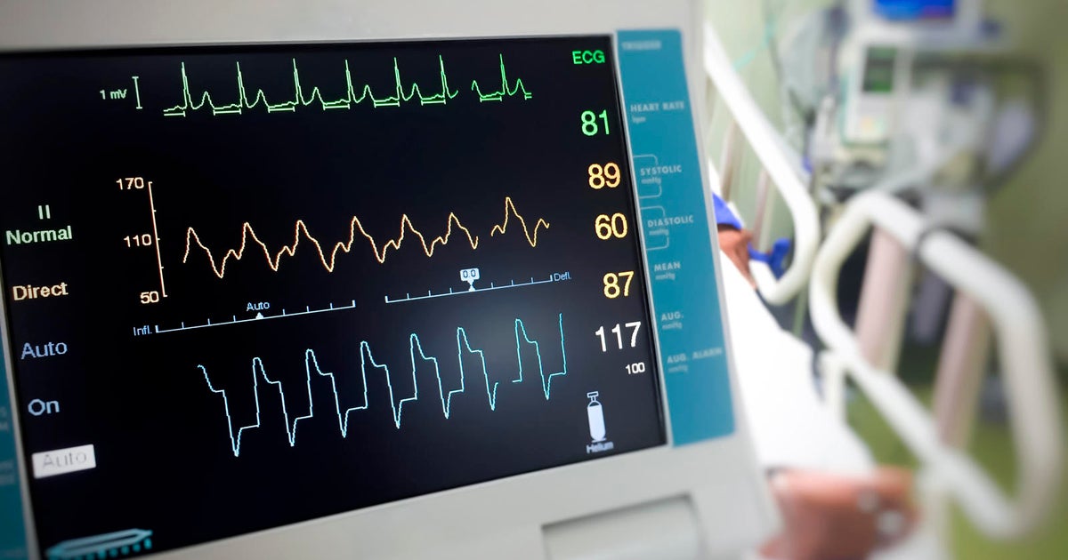 Florida bill would require student athletes to undergo heart screenings before participating sports Florida bill would require student athletes to undergo heart screenings before participating sports