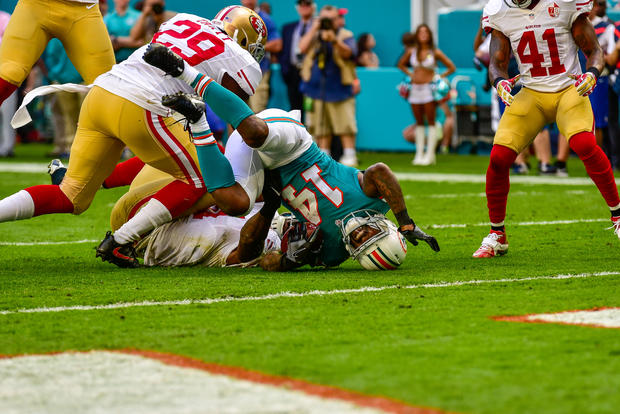 49ers-at-dolphins-22.jpg 