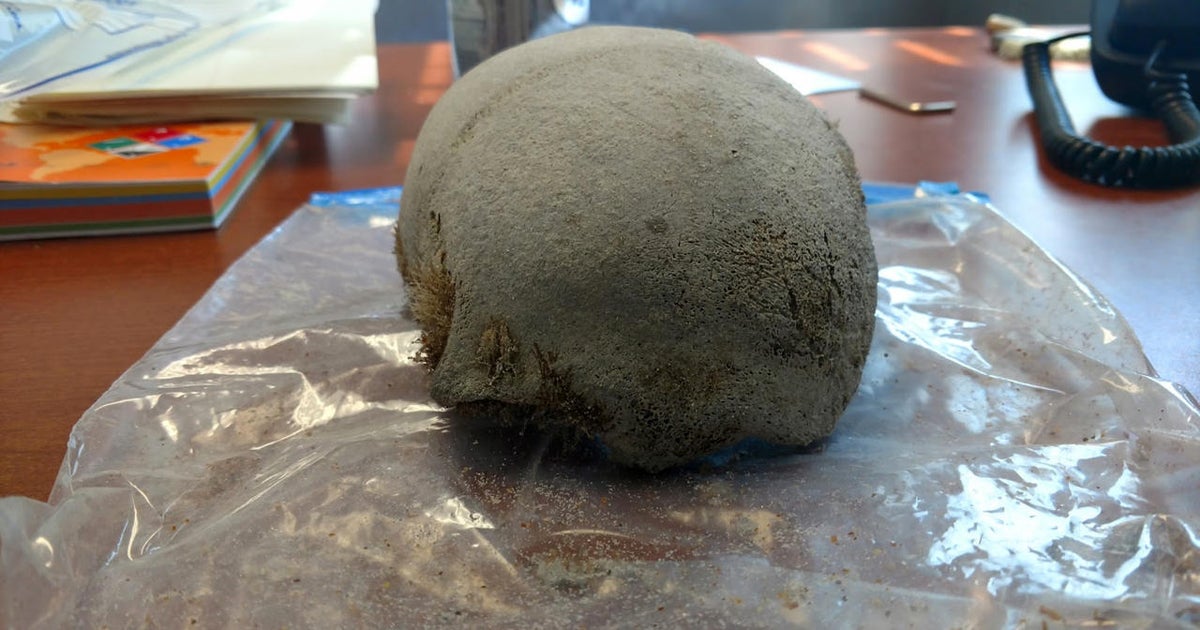 Florida beachgoer finds centuriesold partial human skull, officials(02)