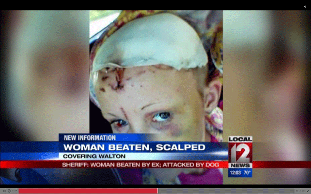 after-attack.gif 