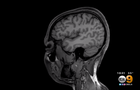 brainscan1.png 