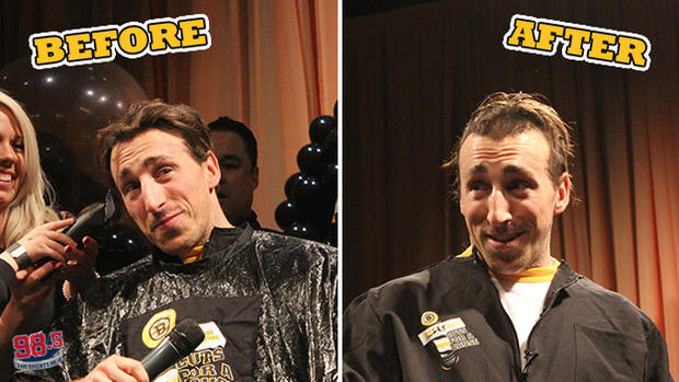 brad-marchand-before-and-after.jpg 