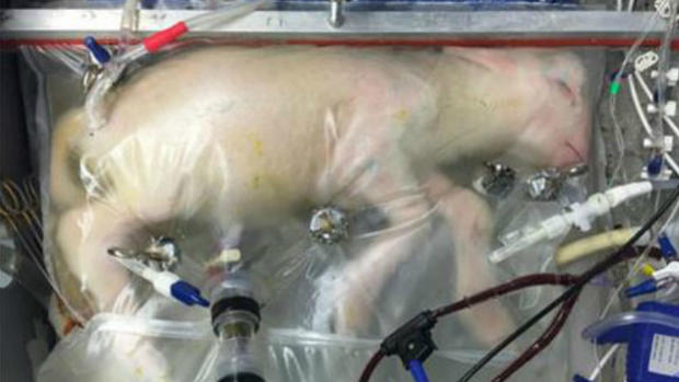 artificial womb, lamb fetus 