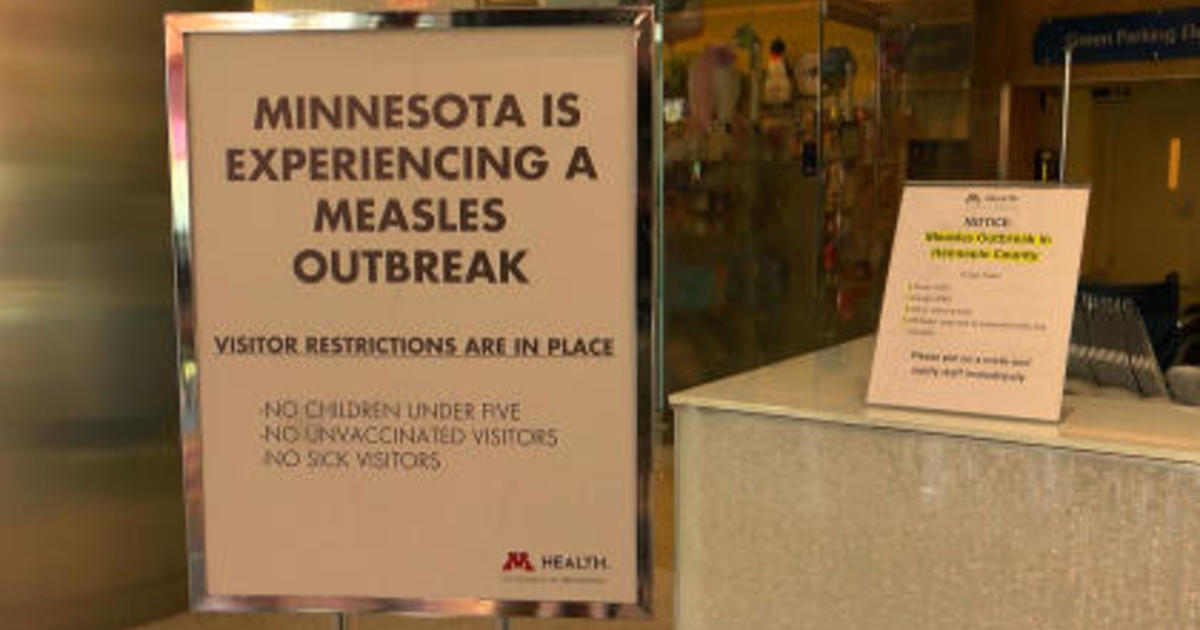 Doctors warn Minnesota measles outbreak still "early" as cases increase