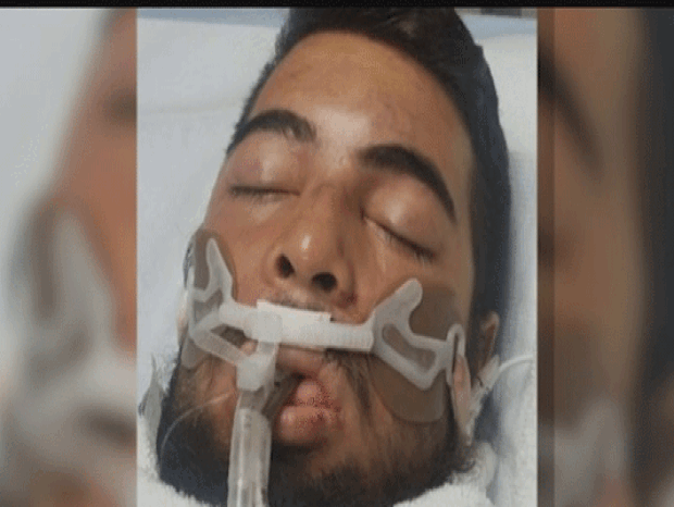 Johnny Hernandez, 24, was taken off life support on May 31, 2017. 