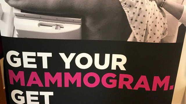 komen-mammograms.jpg 