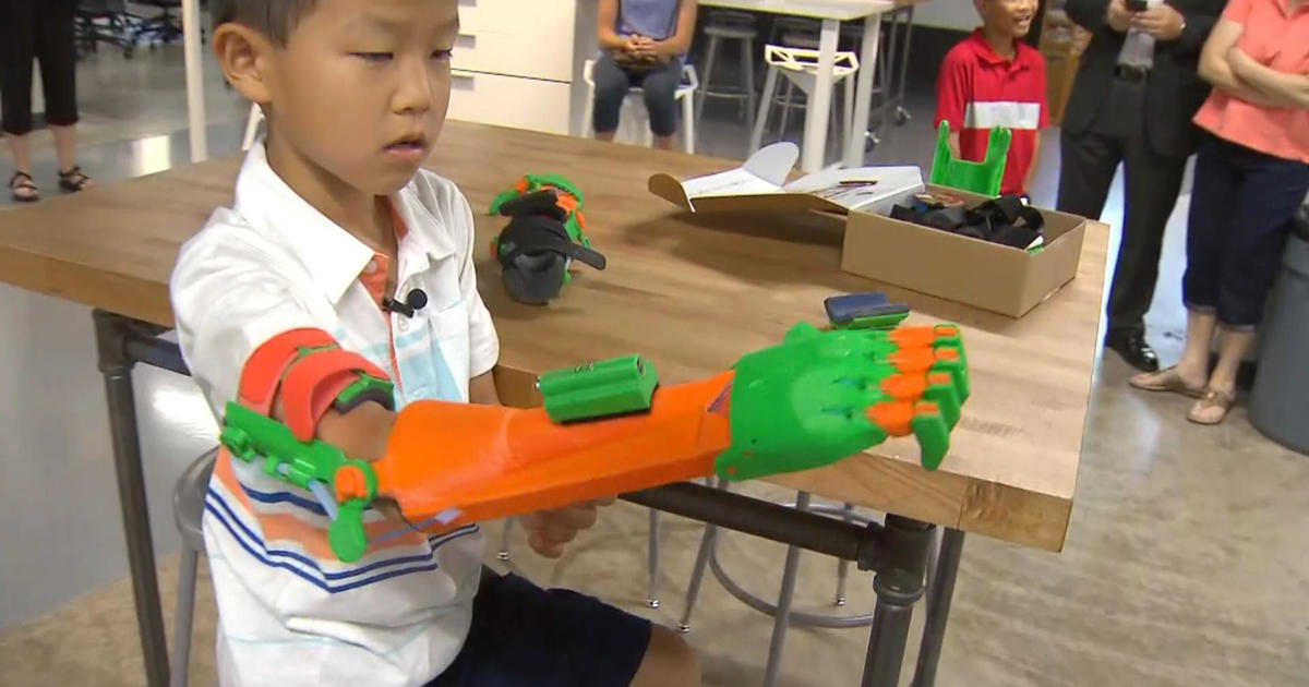 Boy High-fives With New 3D-printed Prosthetic Arm - CBS News