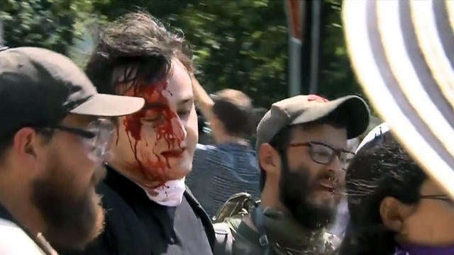 cbsn-0813-xaz-charlottesvilleviolenceanalysis-1374292-640x360.jpg 