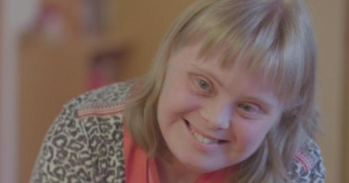 National Geographic's Look at us a little differently campaign highlights  people with Down Syndrome — Aleteia
