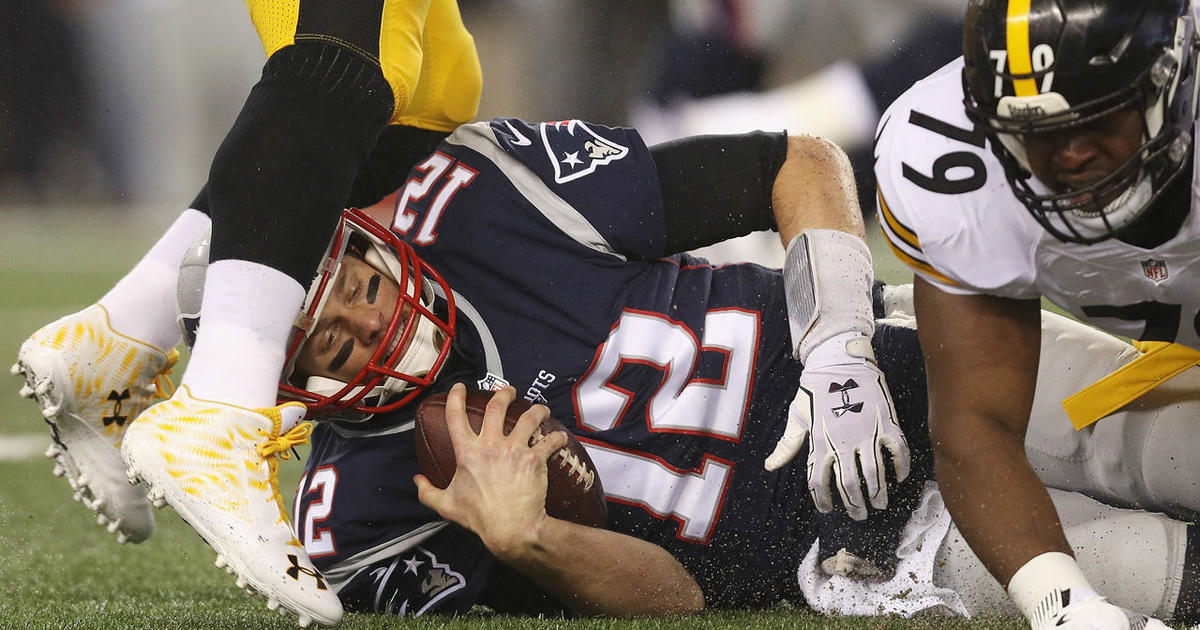 NFL Investigating If Tom Brady Suffered a Concussion