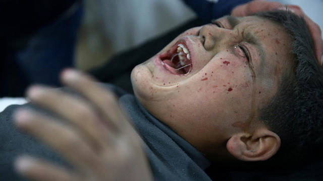 A wounded boy is seen in hospital in the town of Hamoria, eastern Ghouta in Damascus 
