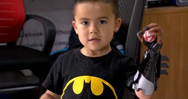 High-tech healers giving kids a helping hand - CBS News