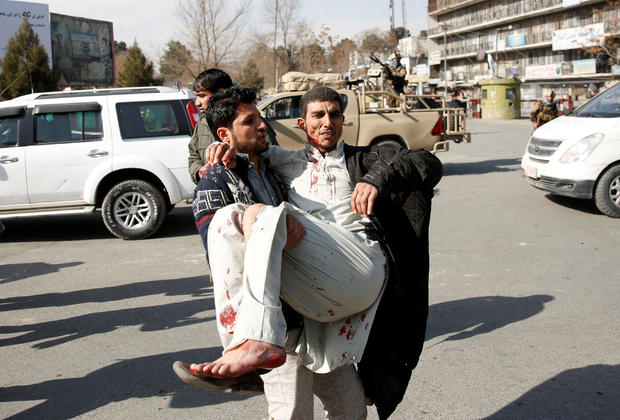 Injured man is carried after a blast in Kabul 
