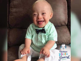 Family of First Gerber Baby with Down Syndrome Speaks Out