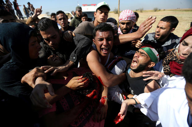 People react as they evacuate Palestinian deaf Tahreer Abu Sabala, 17, who was shot and wounded in the head during clashes with Israeli troops, at Israel-Gaza border, in the southern Gaza Strip 